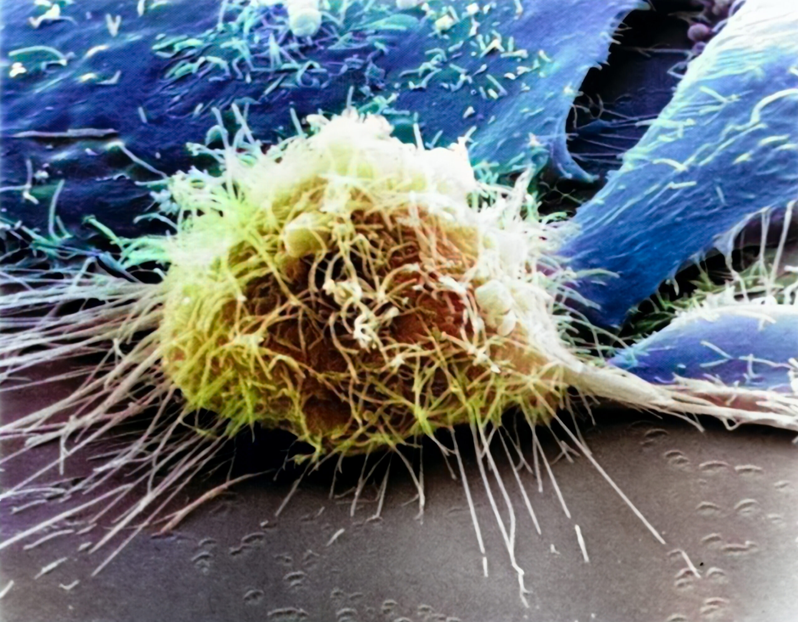 Bionique in Association with ThermoFisher and American Pharmaceutical Review Present: Key Considerations for Implementing Rapid Microbial Methods for Mycoplasma Detection.